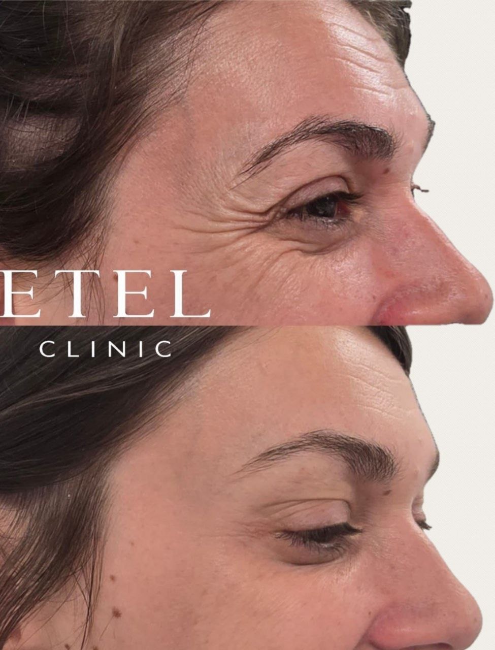 ETEL CLINIC 4