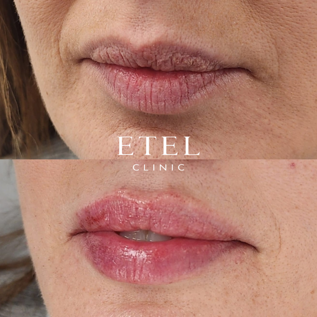 ETEL CLINIC 5
