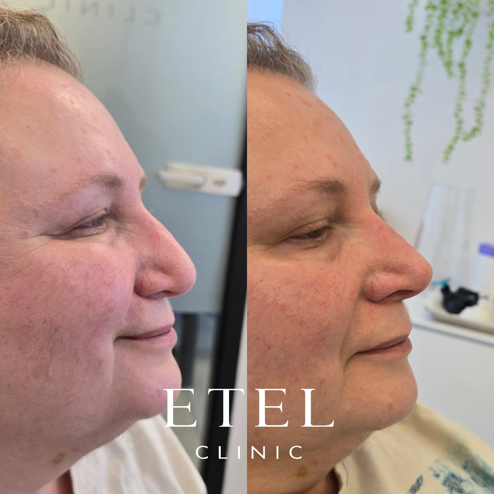 ETEL CLINIC 6